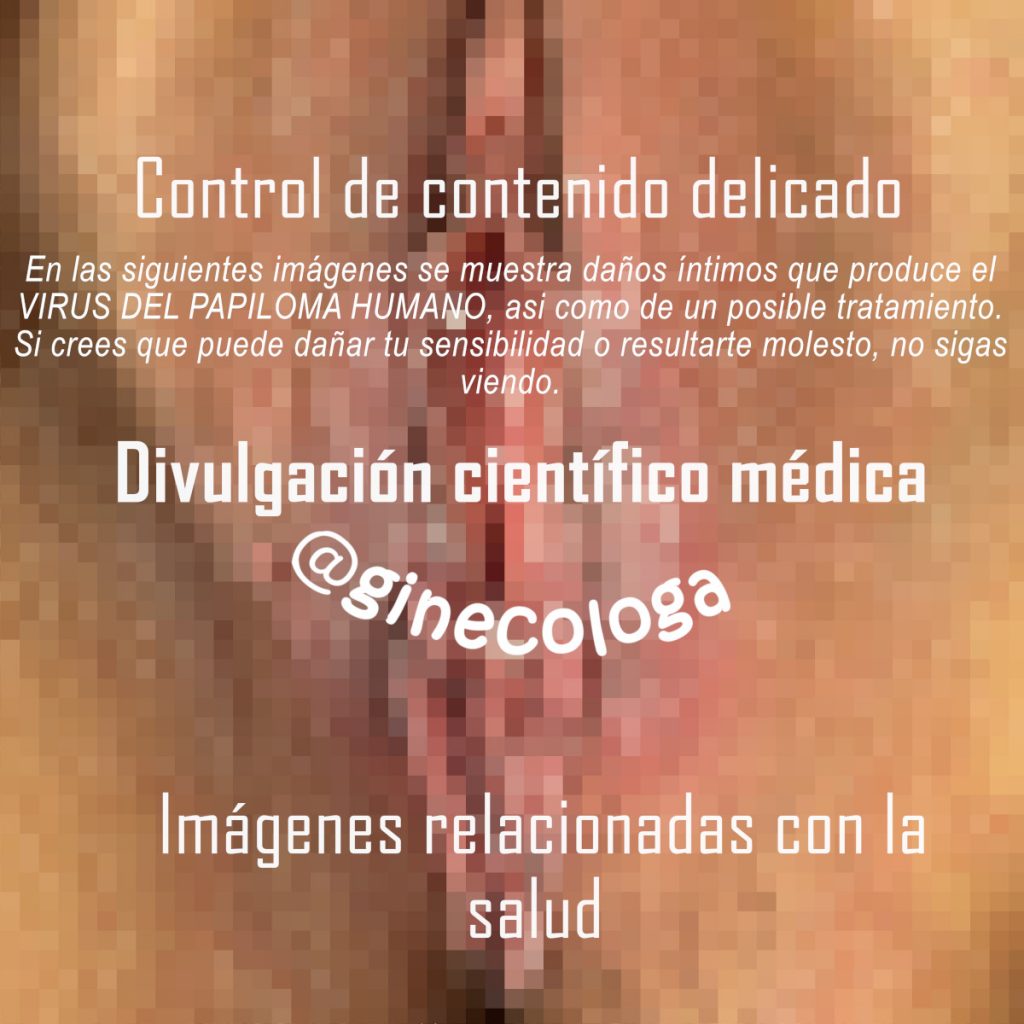 condiciones instagram lesiones vulva vph verrugas